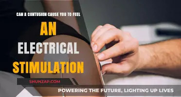 Exploring the Link: Contusions and Electrical Stimulations Explained
