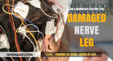 Exploring the Risks: Can Neurology Electric Tests Damage Nerve Function in Legs?