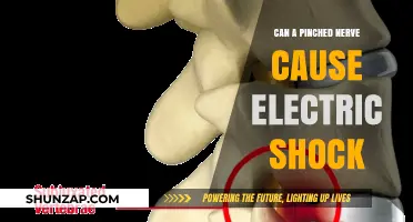 Exploring the Link Between Pinched Nerves and Electric Shock Sensations