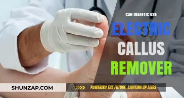 Can Diabetics Safely Use Electric Callus Removers? Expert Advice
