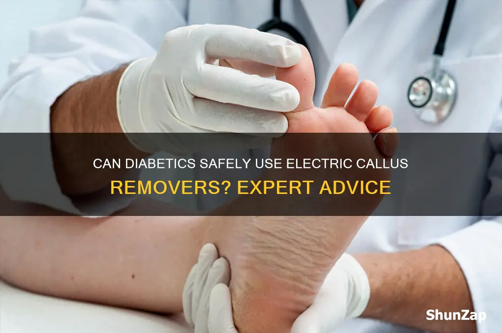 can diabetic use electric callus remover