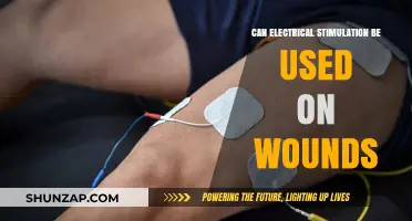 Electrical Stimulation for Wound Healing: Potential Benefits and Applications