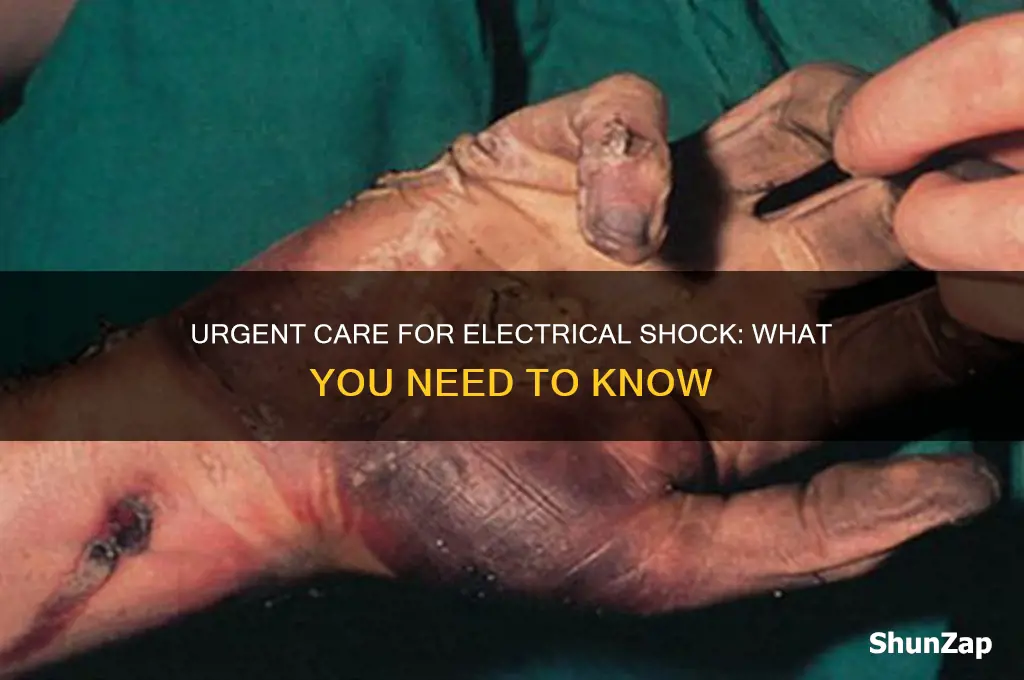 can i go to urgent care for an electrical shock