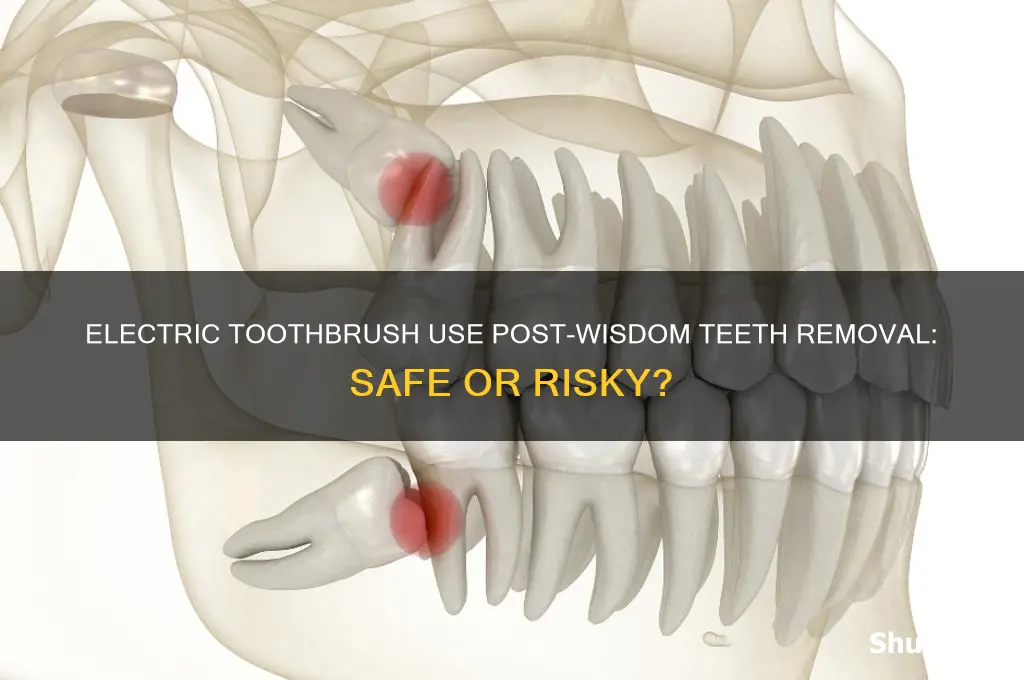 can i use an electric toothbrush after wisdom teeth removal