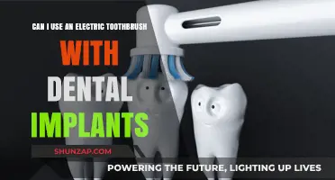 Electric Toothbrushes and Dental Implants: Safe Cleaning Tips