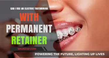 Electric Toothbrush and Permanent Retainer: Safe Cleaning Tips