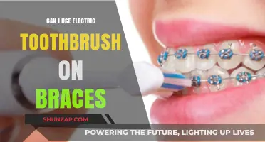 Electric Toothbrushes and Braces: Safe Cleaning Tips for Orthodontic Care