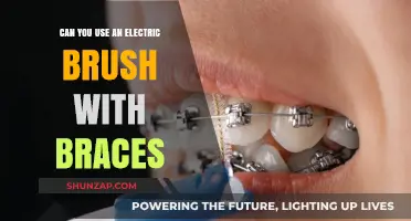 Electric Brushes and Braces: Safe Cleaning Tips for Orthodontic Patients