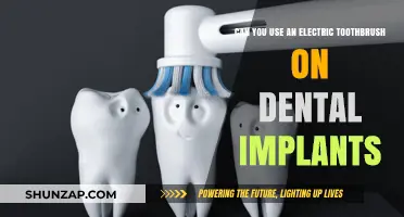 Electric Toothbrushes and Dental Implants: Safe Cleaning Tips