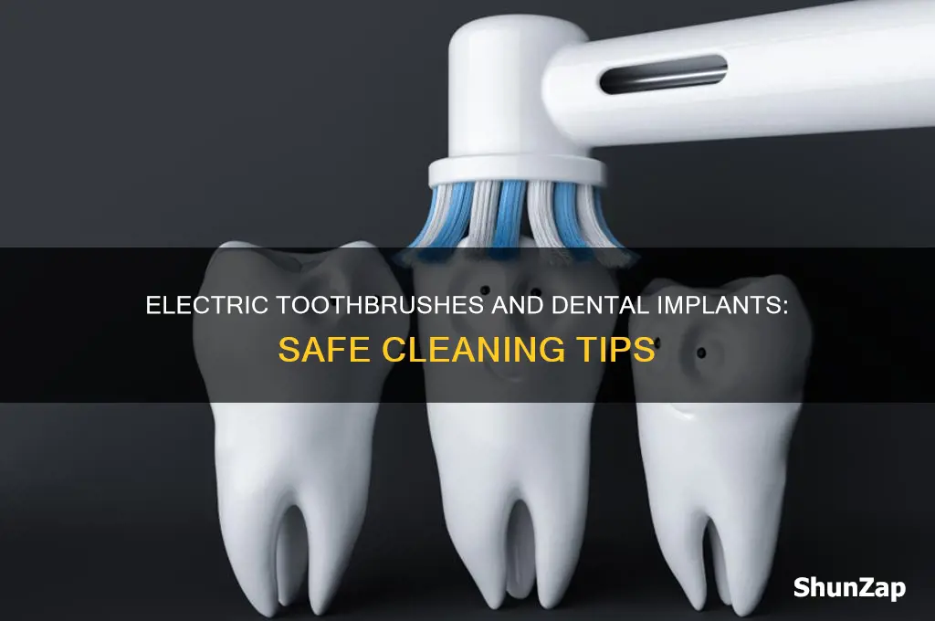 can you use an electric toothbrush on dental implants
