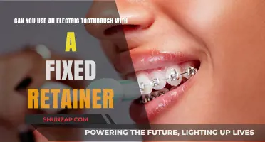 Electric Toothbrush and Fixed Retainer: Safe Cleaning Tips