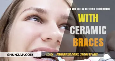 Electric Toothbrushes and Ceramic Braces: A Safe Cleaning Combo?