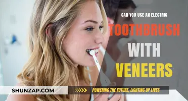 Electric Toothbrushes and Veneers: Safe Cleaning Tips for Your Smile