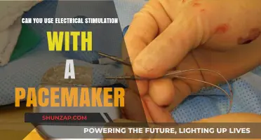 Electrical Stimulation and Pacemakers: Safe Integration or Risky Combination?