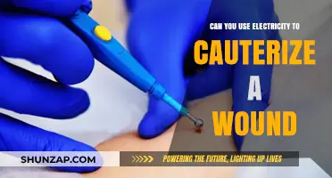 Electricity for Wound Cauterization: Safe, Effective, or Risky Method?