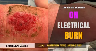 Using Silvadene for Electrical Burns: Safety and Effectiveness Explained