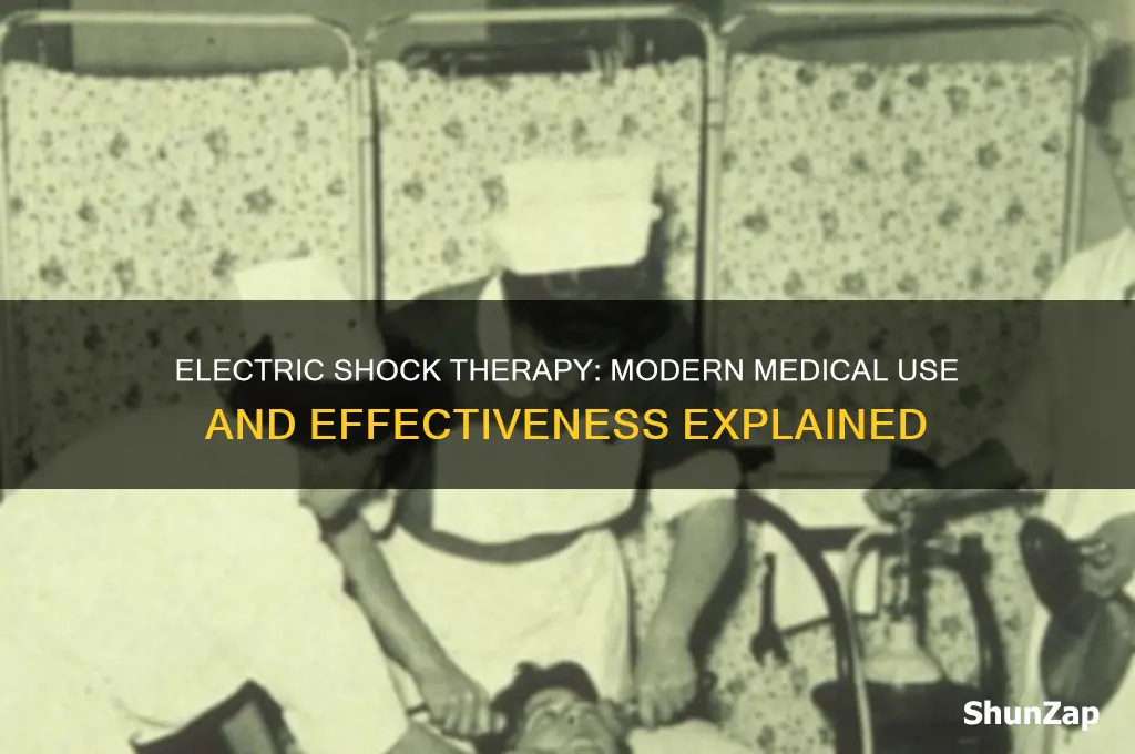 do doctors still use electric shock therapy