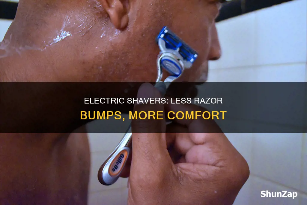 do electric shaver cause less razor bumps