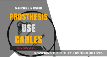Do Electrically Powered Prostheses Use Cables? Exploring Modern Design