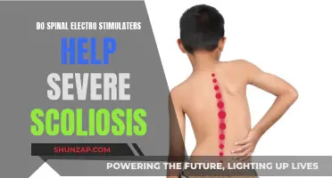 Spinal Electro Stimulation: Effective Treatment for Severe Scoliosis?