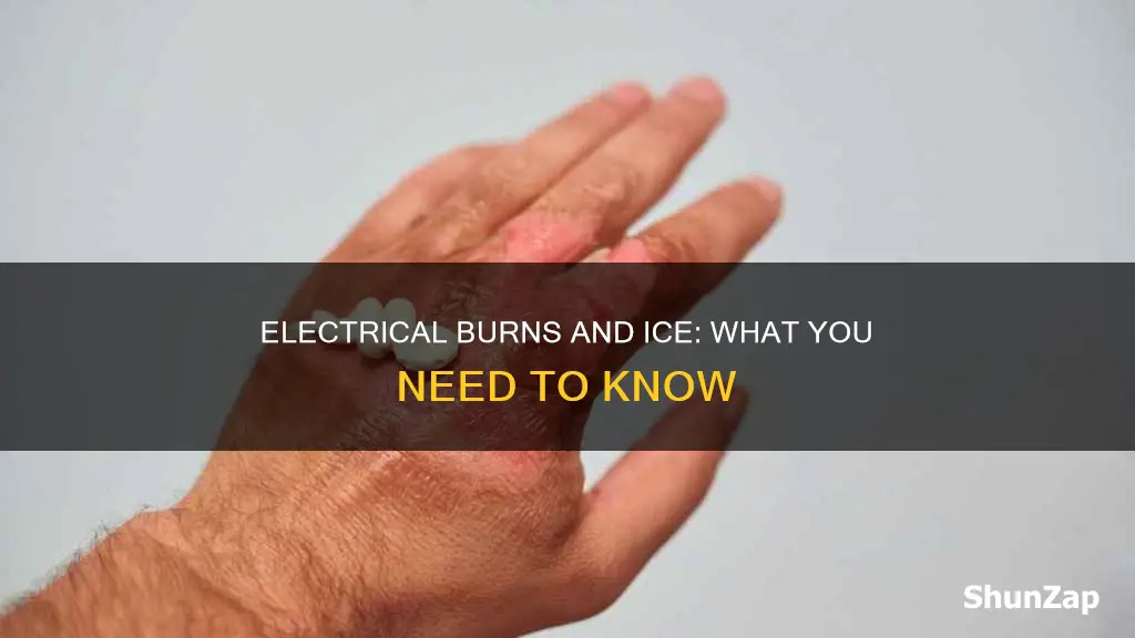 do you put ice on electrical burn
