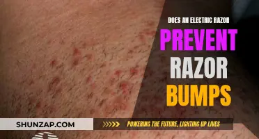 Electric Razor Benefits: Preventing Razor Bumps and Irritation