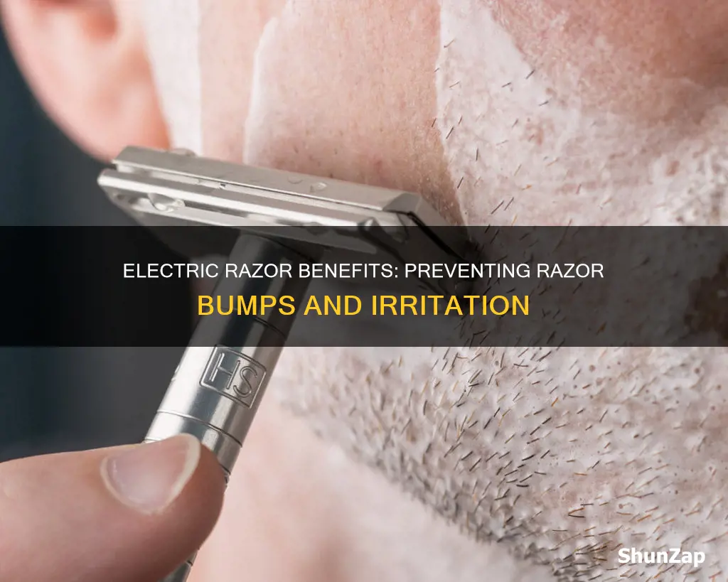 does an electric razor prevent razor bumps