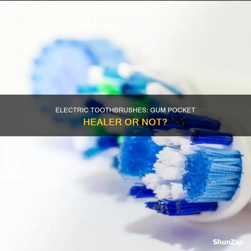 does an electric toothbrush help gum pockets