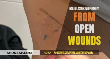 Electric Whip and Open Wounds: What's the Connection?