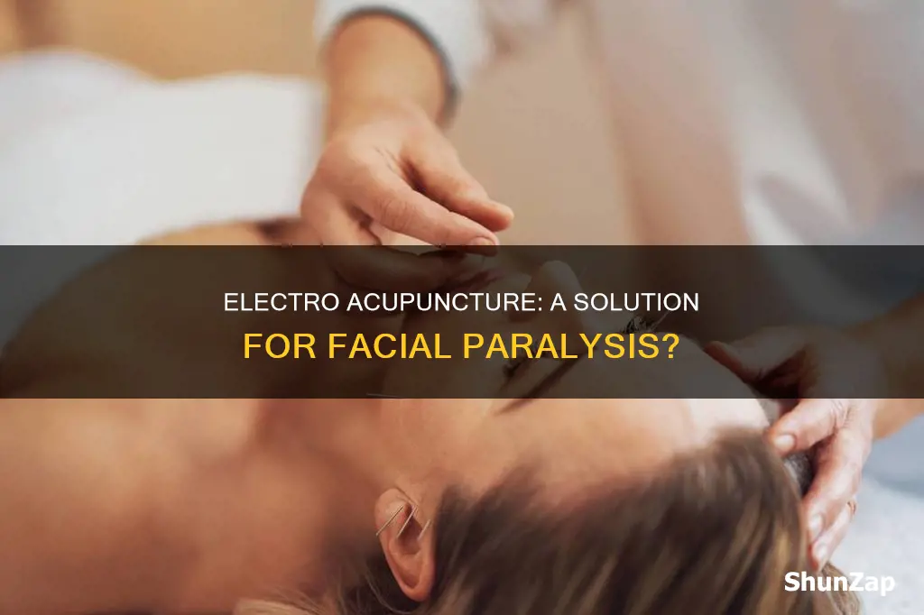 does electro acupuncture help with facial paralysis