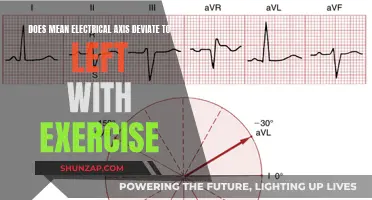 Electrical Axis Deviation: Exercise Impact on Heart Health