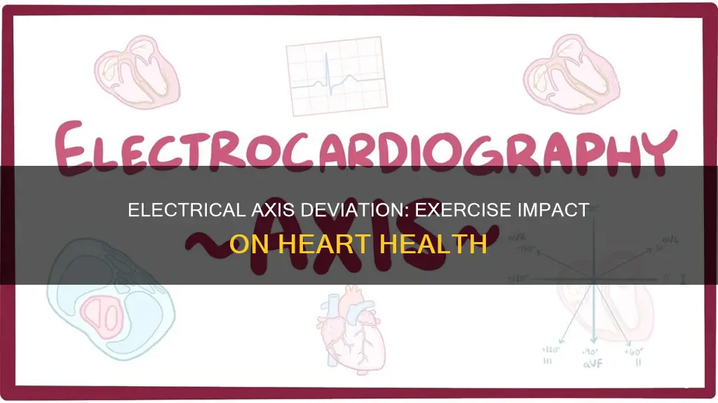 does mean electrical axis deviate to left with exercise