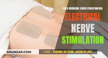 Percutaneous Electrical Nerve Stimulation: Is Medicare Coverage Available?