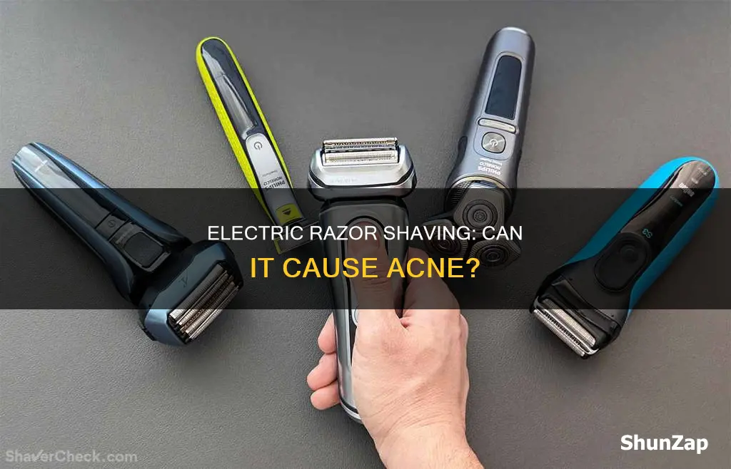 does shaving with electric razor cause acne