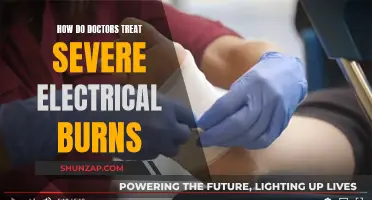 Electrical Burns: Treating Severe Cases and Saving Lives