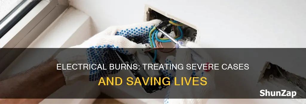 how do doctors treat severe electrical burns