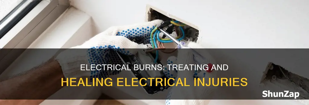 how do i treat an electrical burn