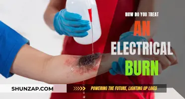Electrical Burns: Treating and Managing the Damage