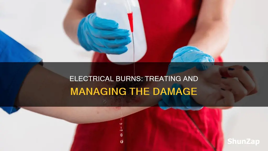 how do you treat an electrical burn