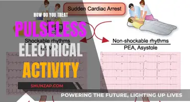 Treating Pulseless Electrical Activity: A Comprehensive Guide