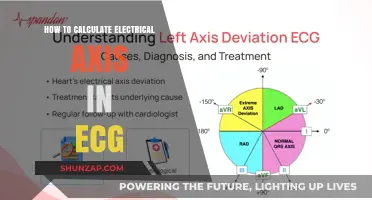 Understanding ECG Electrical Axis: Calculating Heart's Electrical Position