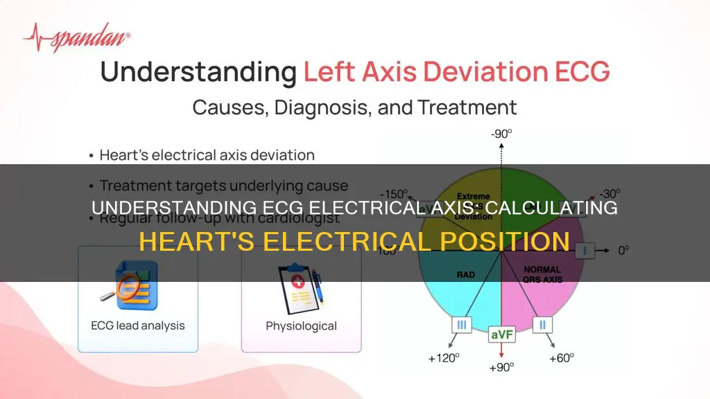 how to calculate electrical axis in ecg