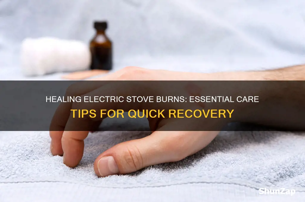 how to care for electric stove burns