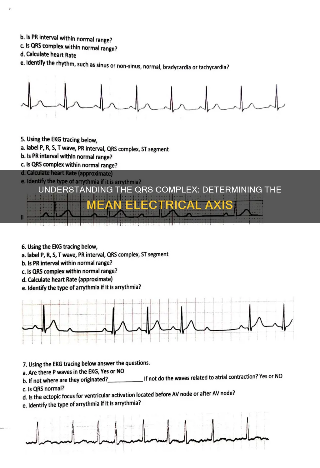 how to determine mean electrical axis of qrs complex