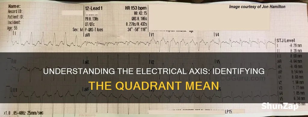 how to know which quadrant is mean electrical axis