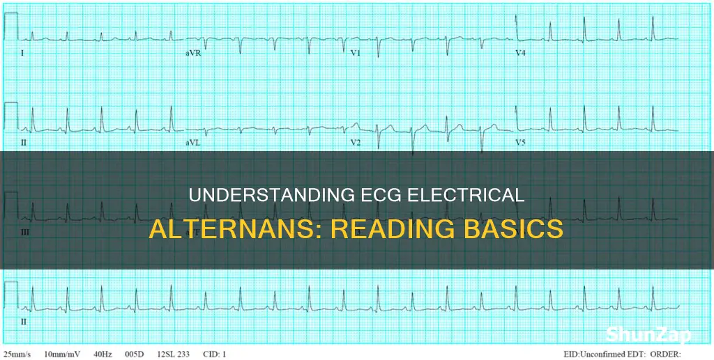 how to read electrical alternans on ecg
