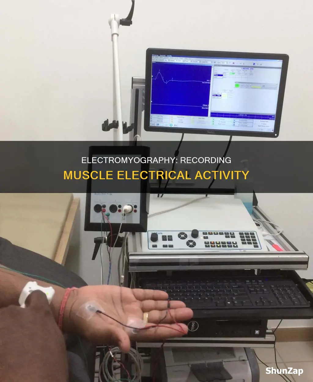 how to record electrical activity in muscles