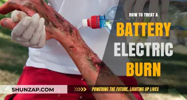 Treating Electric Burns: First Aid for Battery Burns