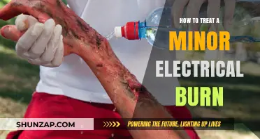 Treating Electrical Burns: Quick and Easy Home Remedies