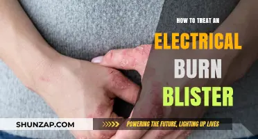 Electrical Burn Blisters: Quick and Effective Treatments